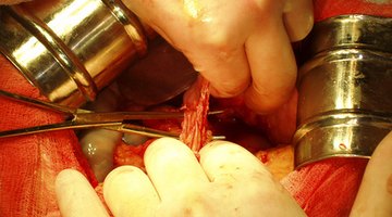 ¿Cuáles son los niveles normales de oxígeno en la sangre?