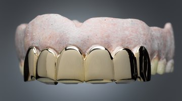 Cómo colocar una corona dental sin el dentista