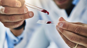 ¿Qué es un médico hematólogo?