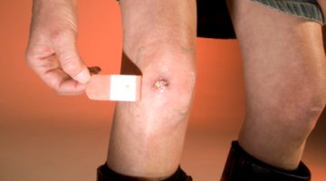 ¿Cómo tratar una costra?