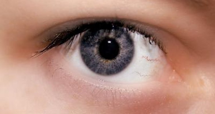 Remedios caseros para los ojos hundidos.